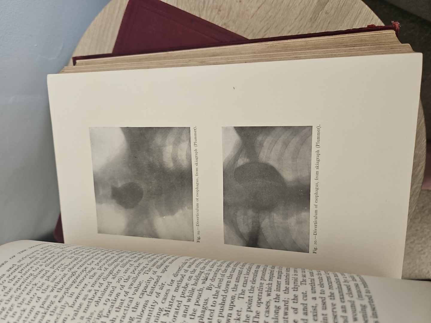 Vintage Medical books by Musser and Kelly