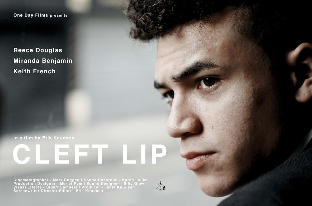 Cleft Lip (2018)