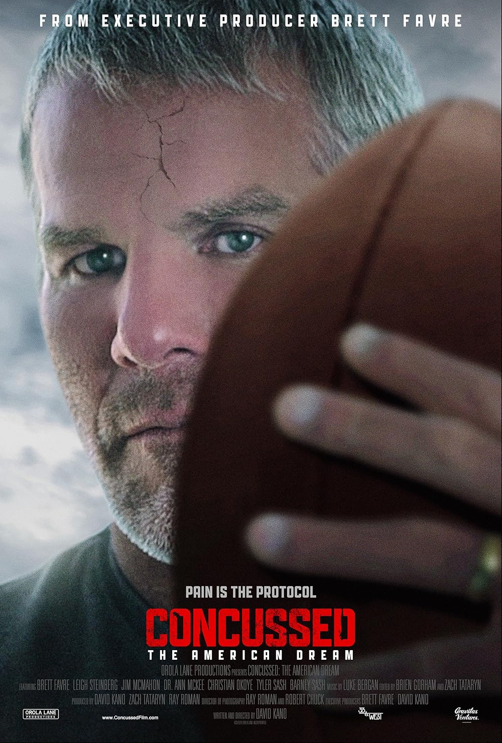 Concussed - The American Dream (2024)