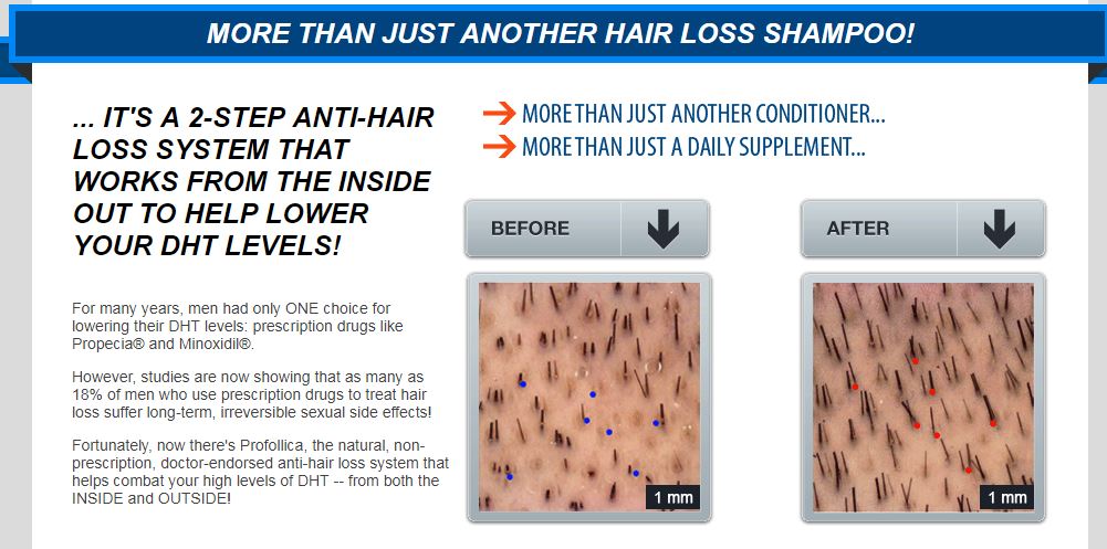 Put a Stop to Hair Loss and Look Years Younger with a Natural Hair Loss Product by Profollica