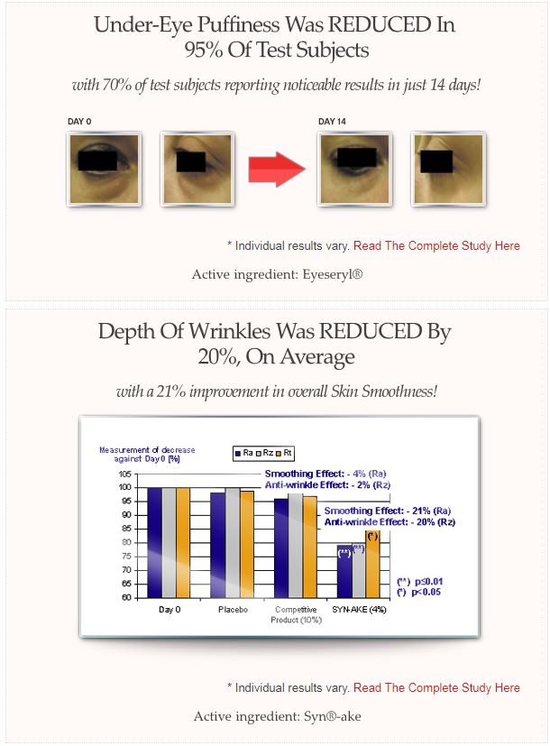 Get Rid of Dark Cycles - Eyeslasticity For Vibrant Young Eyes in just 14 days!