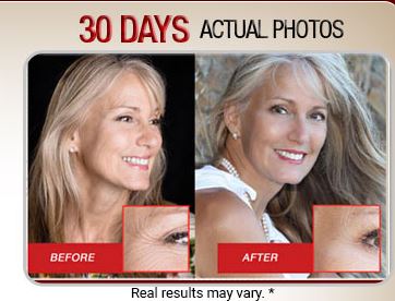 Kollagen Intensiv™ Accelerate Your NATURAL Collagen Production In Just 84 Days