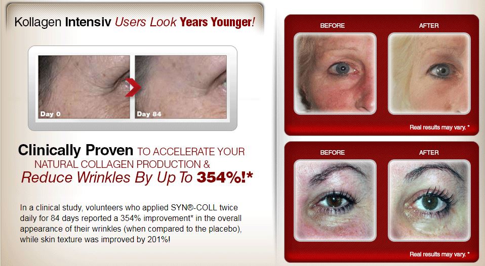 Kollagen Intensiv™ Accelerate Your NATURAL Collagen Production In Just 84 Days