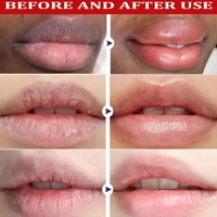 Remove Dark Lip Balm Lighten Melanin Lip Mask Exfoliating Fade Lip Line Dead Skin Moisturizing Brigh