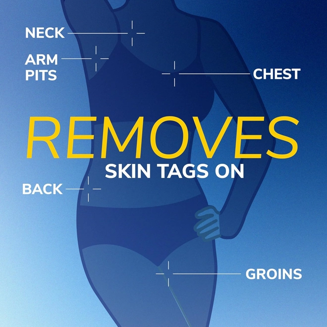 Additional Image for Dr. Scholl's Freeze Away Skin Tag Remover Kit, 8 ct – Completely removes Skin Tags in As Little As 1