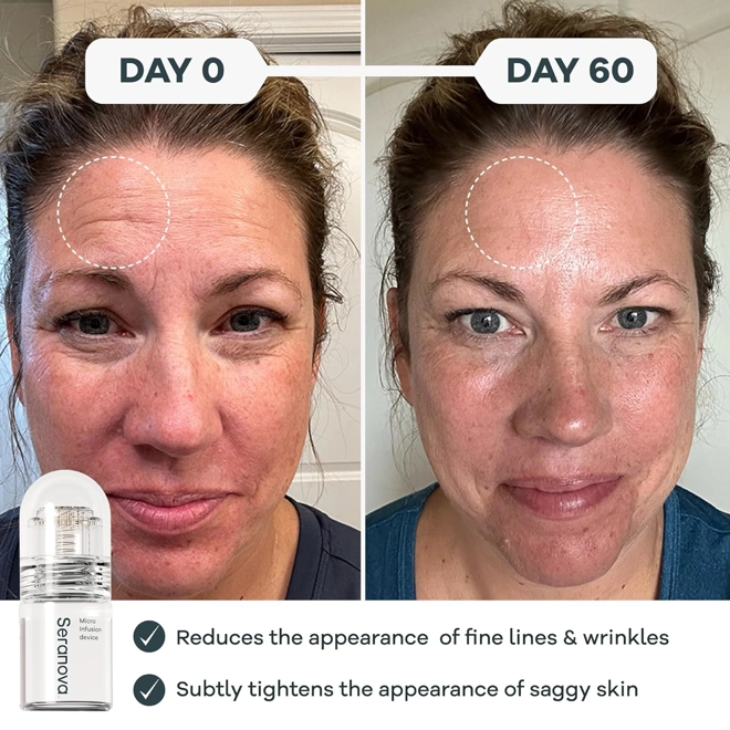 Additional Image for Seranova Micro Infusion for Skin Care, Facial Moisturizing Essence, Serum Smooth Skin Facial Serum f