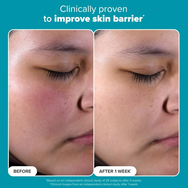 Additional Image for Paula's Choice SKIN PERFECTING 2% BHA Liquid Exfoliant Polish, Salicylic Acid Exfoliant-Facial Polis