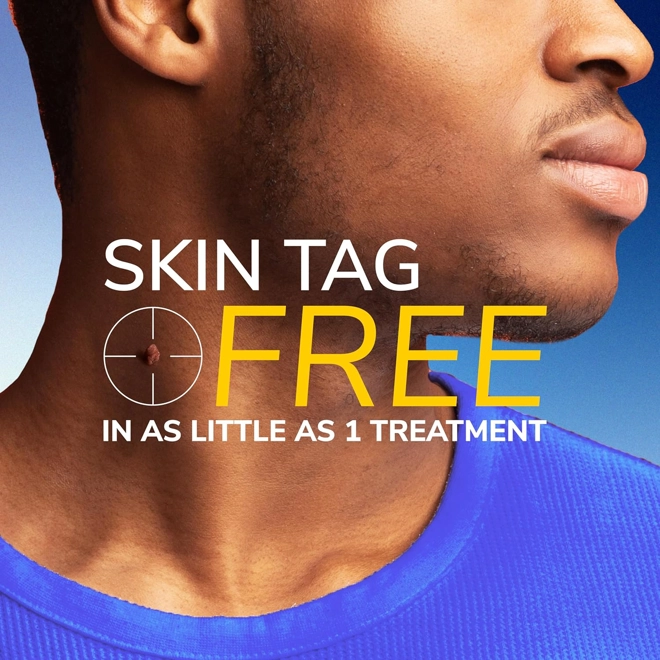 Additional Image for Dr. Scholl's Freeze Away Skin Tag Remover Kit, 8 ct – Completely removes Skin Tags in As Little As 1