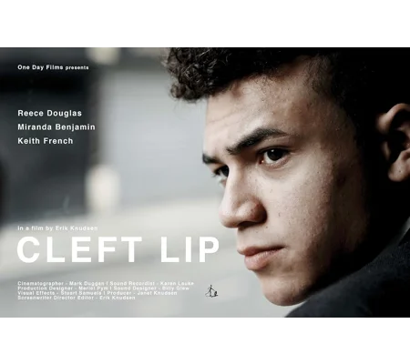 Cleft Lip (2018)