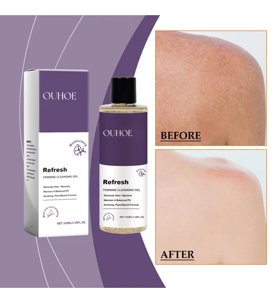 OUHOE Balance Bath Gel – Gentle Feminine Hygiene & Moisturizing Body Cleanser with Witch Hazel & Vit