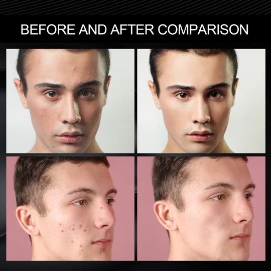 Men's Skinfree Concealer & Face Cream | KEEPSORA