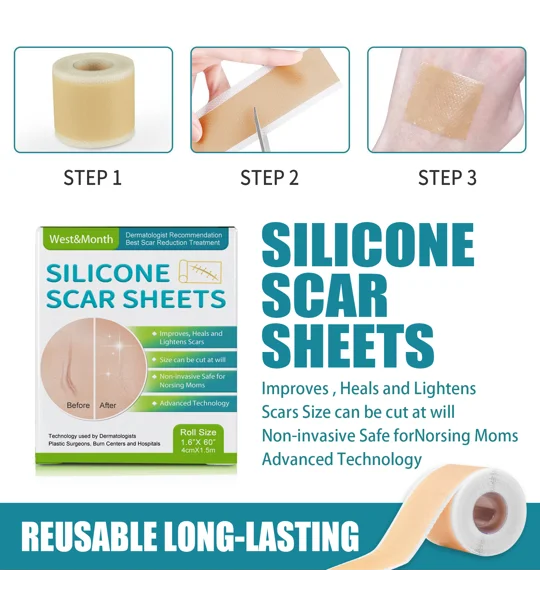 Self-Adhesive Silicone Scar Sheets – Cut-to-Fit Scar Care Strips – FREE SHIPPING