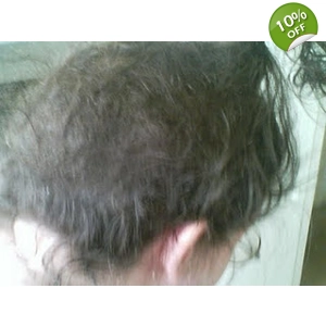 Removal Video Kit- Matted Hair Clumps/Knots