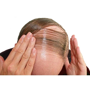 HAIR GROWTH BALDNESS CURE MAGIC SPELL CAST