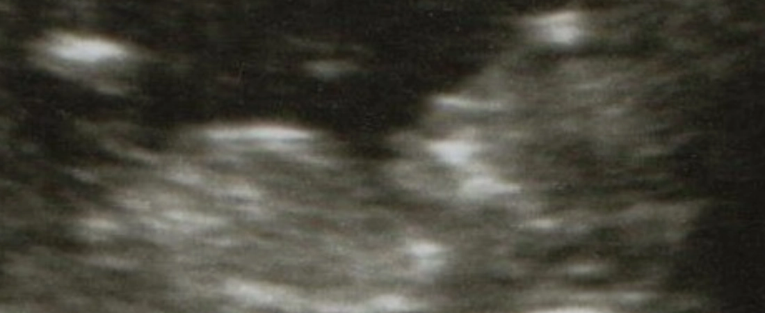 I am fearfully and wonderfully made.