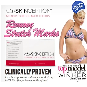 Erase Stretch Marks with Skinception Intensive Stretch Mark Therapy