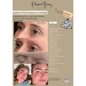 Level 4 Laser Tattoo Removal Course Liverpool