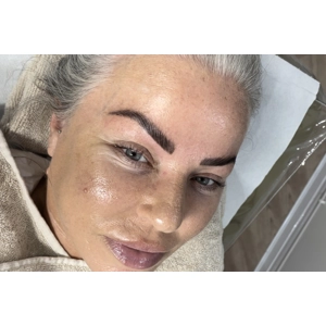 Brow Lamination