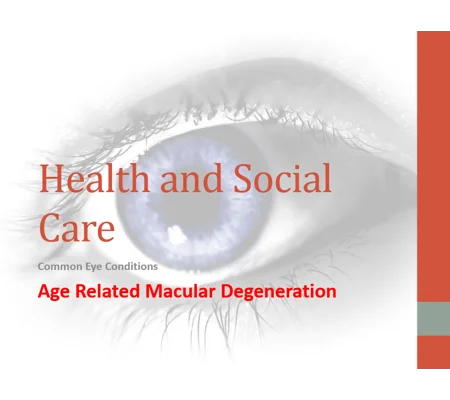 Age Related Macular Degeneration Awareness Training Resources
