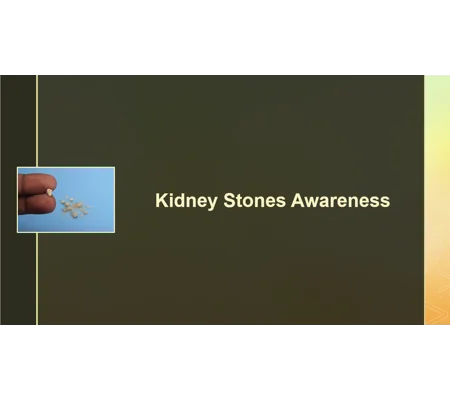 Kidney Stones Awareness Training Resources