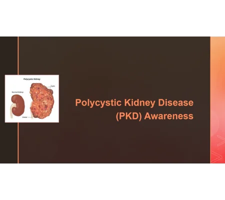 Polycystic Kidney Disease Awareness Training Resources