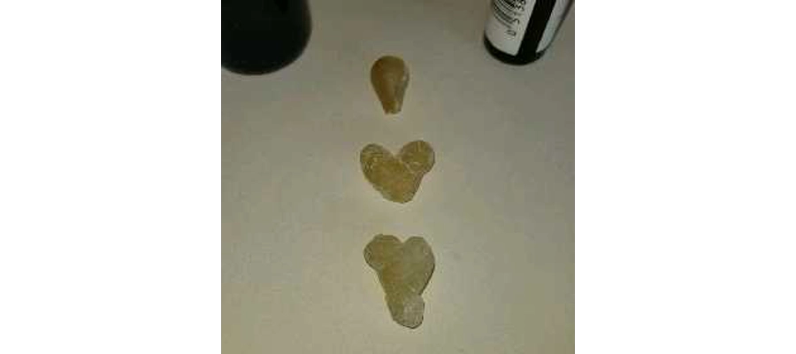 Frankincense Hojari Superior Resin Gum Tears (Boswallia Sacra) $30.00 oz.