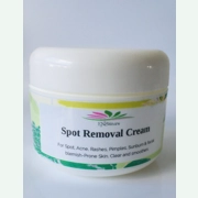Spot Removal Cream - 100ml