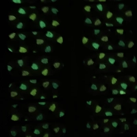 Light It Up (Glow in the Dark)