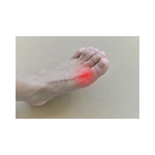 Gout Away Cream. Holistic natural support