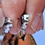 RI2 RIELDA Key Blanks .Suitable for Rielda RS1 Locks