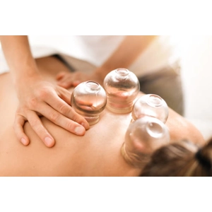 Cupping Therapy