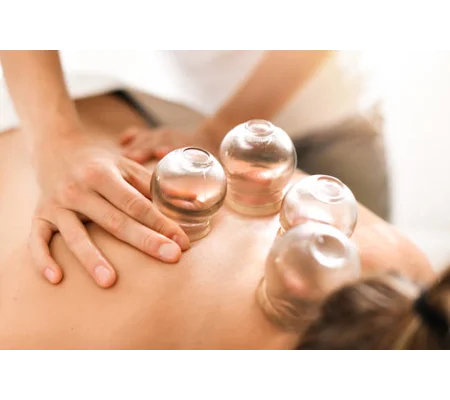Cupping Therapy