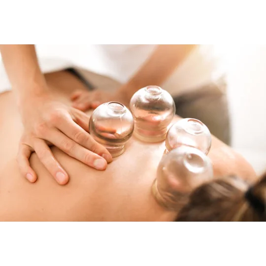 Cupping Therapy