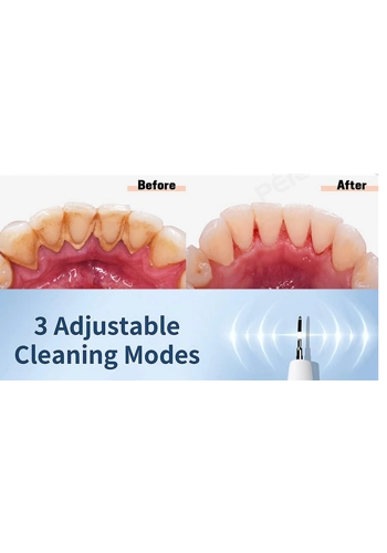 Dental plaque remover