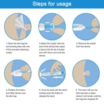 Wart Remover Wart Remover