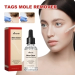 Ximonth 20ml/Bottle Anti Mole And Wart Ximonth 20ml/Bottle Anti Mole And Wart