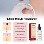 Ximonth 20ml/Bottle Anti Mole And Wart Ximonth 20ml/Bottle Anti Mole And Wart